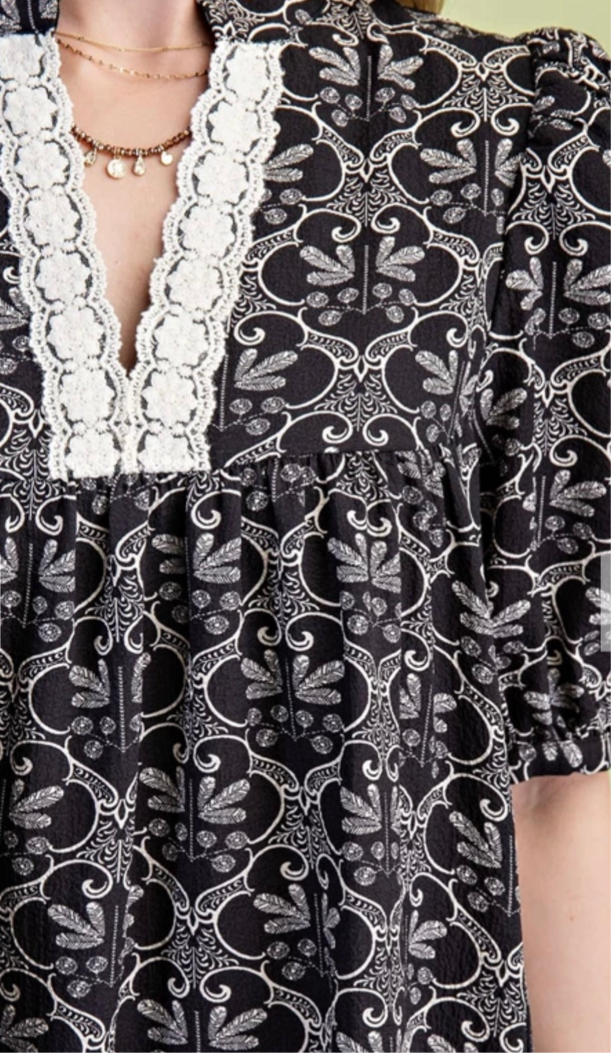 Black and White Printed Dress with Lace Detail